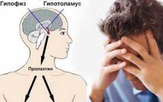 Повышенный пролактин у мужчин: причины, симптомы и лечение