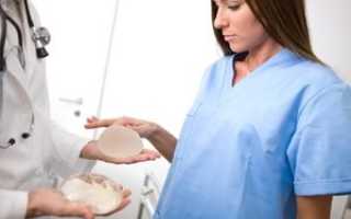 Пластика грудных (молочных желез): виды и методики этой операции