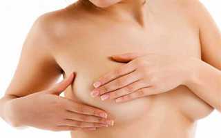 Выделения из молочных желез: причины и лечение