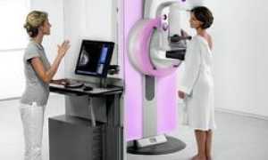 Маммография молочной железы: зачем проводится это исследование, на какой день делать, стоимость
