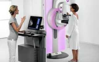 Маммография молочной железы: зачем проводится это исследование, на какой день делать, стоимость