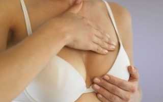 Мастодиния (масталгия): симптомы и лечение