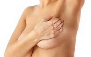 Лимфаденопатия (изменение) подмышечных лимфоузлов: причины, симптомы и лечение