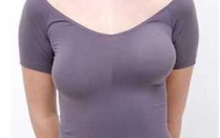 Подтяжка груди (мастопексия): когда и как проводится эта операция