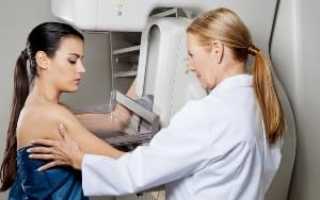 УЗИ молочных желез: когда и у кого проводится, что показывает, сколько стоит