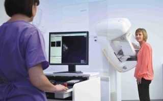 Цифровая маммография: что выявляет, когда проводится, преимущества и стоимость такого обследования