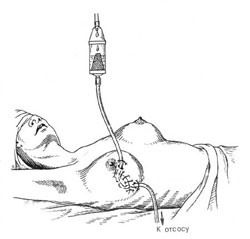 малоинвазивный способ лечения