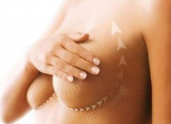 схема подтяжки груди