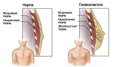 молочная железа мужчины