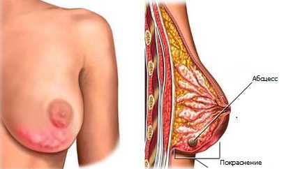 рисунок молочной железы