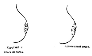 женская грудь