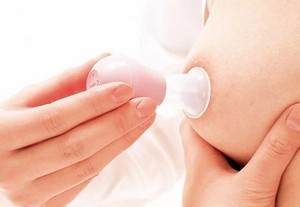 молокоотсос