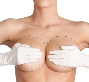 редукционная маммопластика