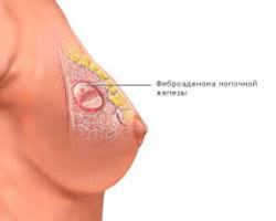 обследование груди обследование груди