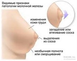 заболевание