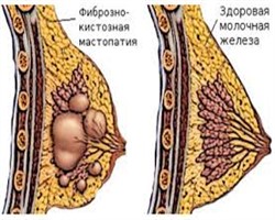 консервативное лечение консервативное лечение