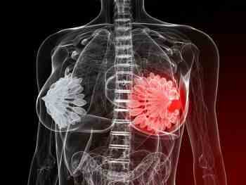 болезнь могут вызвать самые разные состояния болезнь могут вызвать самые разные состояния