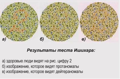 Тест Ишихара для диагностики дейтеранопии