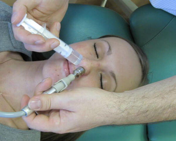 Как проводится лечение острого полисинусита