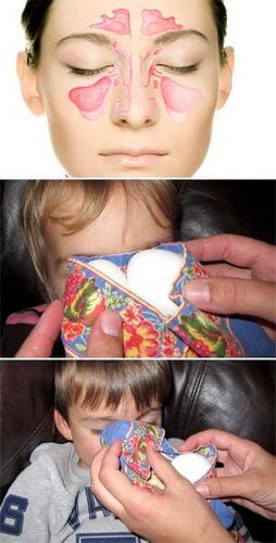 Можно ли греть нос в домашних условиях