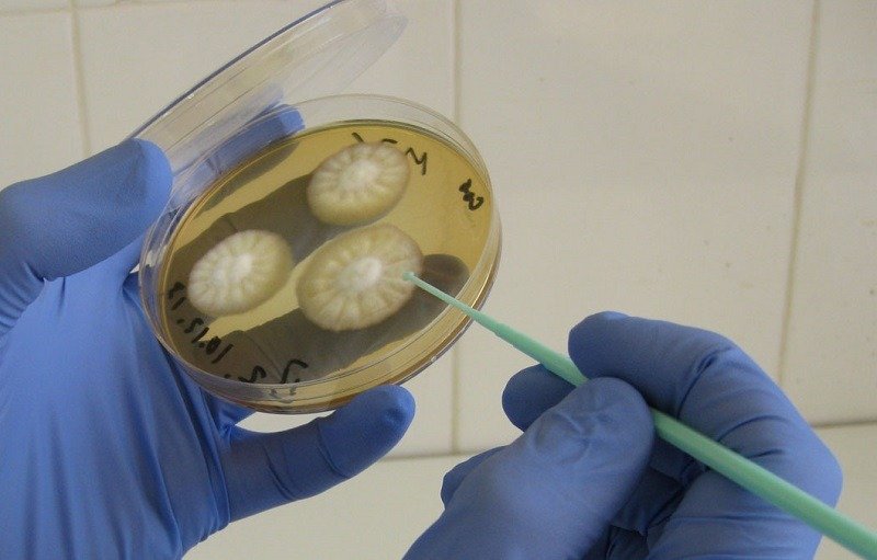 Посев на среду Сабуро - надежный метод диагностики