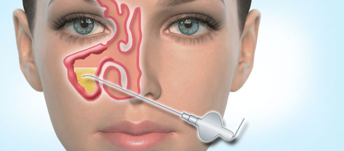 Прокол носа