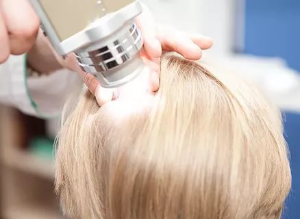 Рубцовая алопеция практически не поддается лечению, выручит только пересадка волос