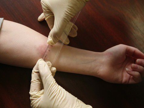 Возбудителем заболевания является палочка Коха