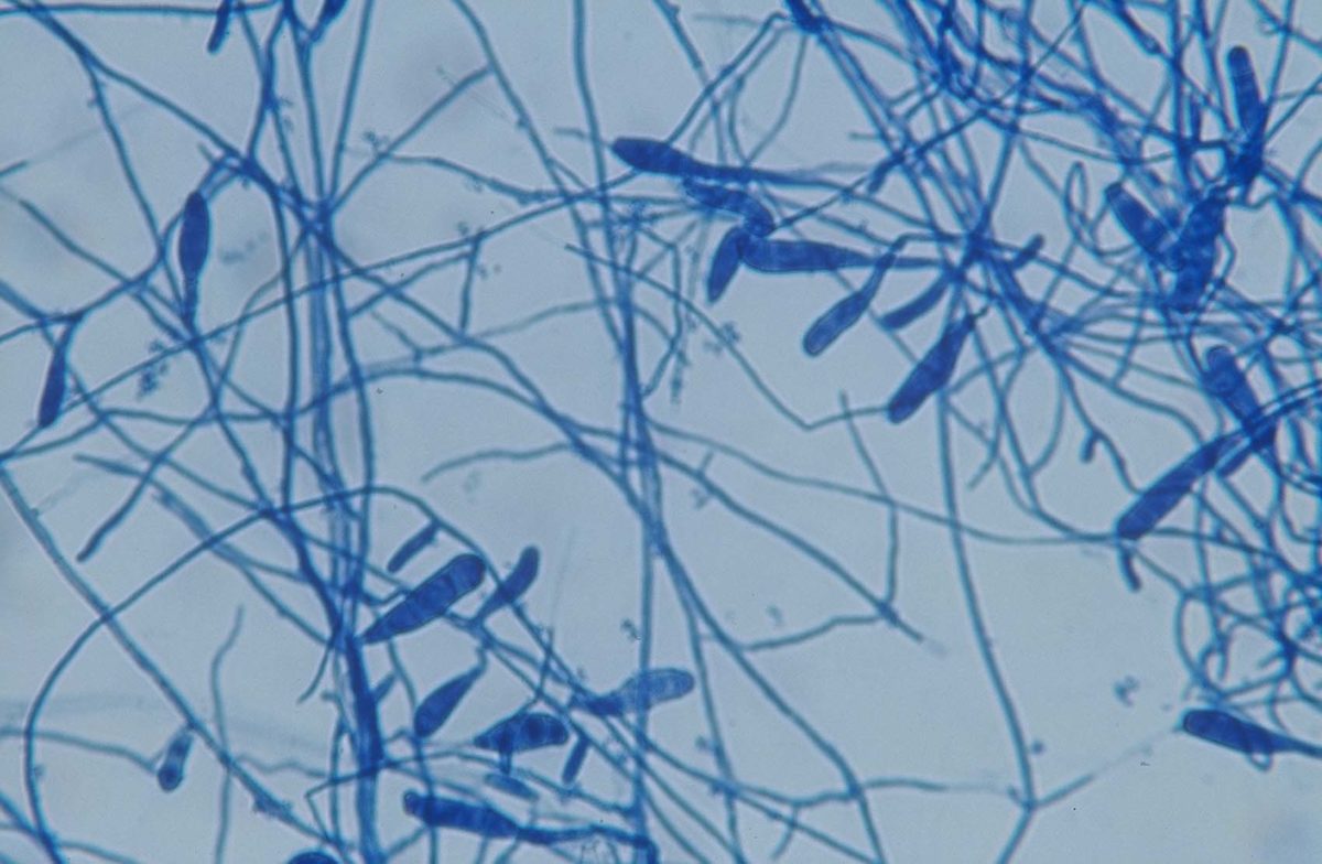 Возбудителем заболевания являются споры грибка трихофитона