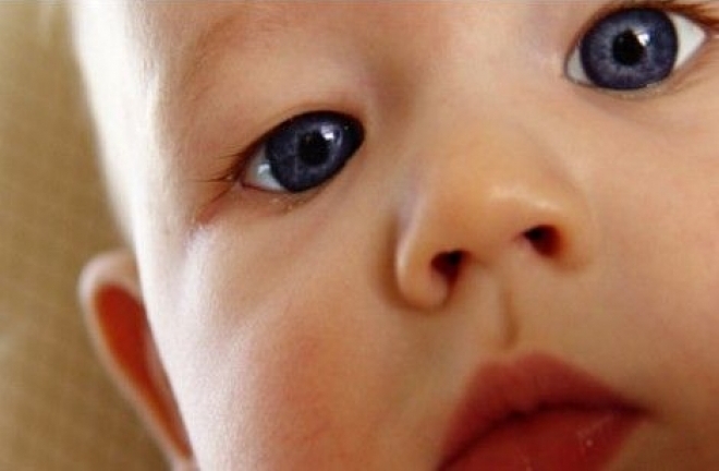 Врожденным считается косоглазие, которое проявляет себя в первые полгода жизни ребенка