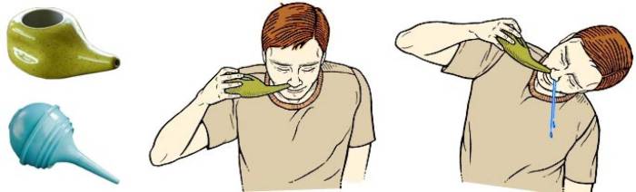 Правильное промывание носа с помощью специальных чайничков и необходимый наклон головы