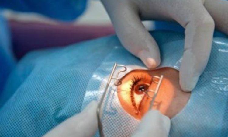 Операция по удалению ячменя или фурункула