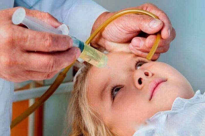 Процедура "Кукушка" проводится ребенку