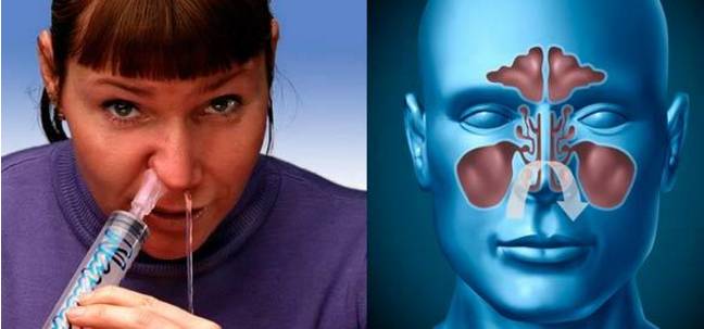 Промывание носа