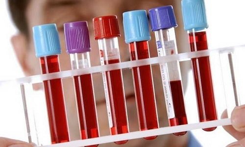Общее и биохимическое исследование крови используется только при наличии осложнений