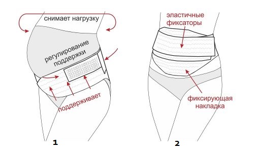 Конструкция дородового (1) и послеродового (2) бандажей