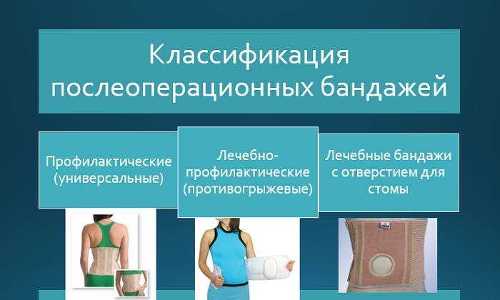 Ассортимент ортопедических изделий для фиксации позволяет подобрать бандаж в каждом индивидуальном случае